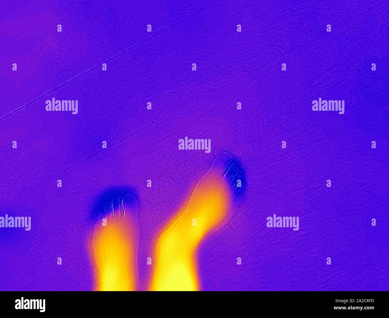 Thermografiebild der Wärmebildkamera mit hellen Bereichen, die höheren Temperaturen entsprechen und die Füße und Zehen eines Mannes zeigen, mit Zehen bei niedriger Temperatur, was auf eine schlechte Durchblutung oder einen ähnlichen Zustand hindeutet, San Ramon, Kalifornien, September 2019. () Stockfoto