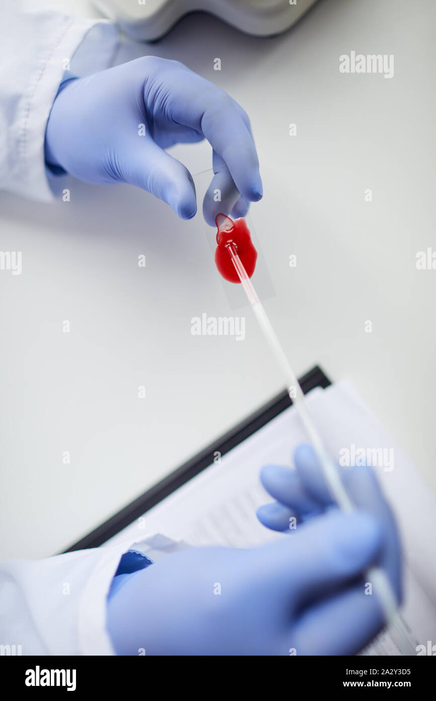 In der Nähe von Doktor Schutzhandschuhe holding Glas mit Blutprobe in seine Hände und die medizinische Untersuchung im Labor Stockfoto