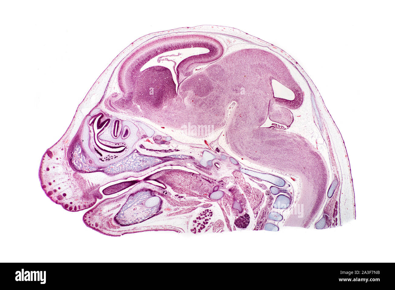 Maus späten Embryo VLS Kopf, Seitenansicht Stockfoto