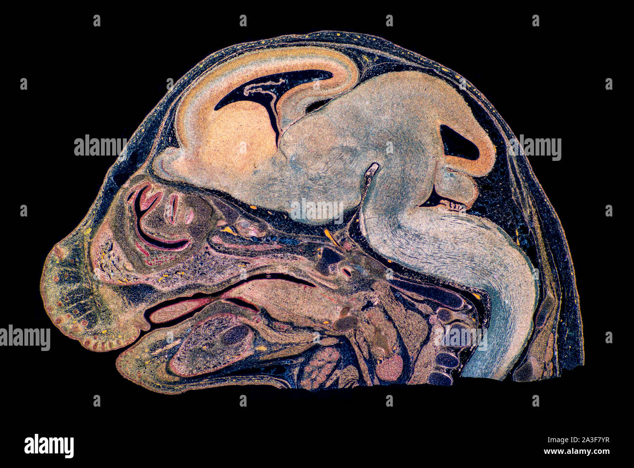 Maus späten Embryo VLS Kopf, Seitenansicht Stockfoto