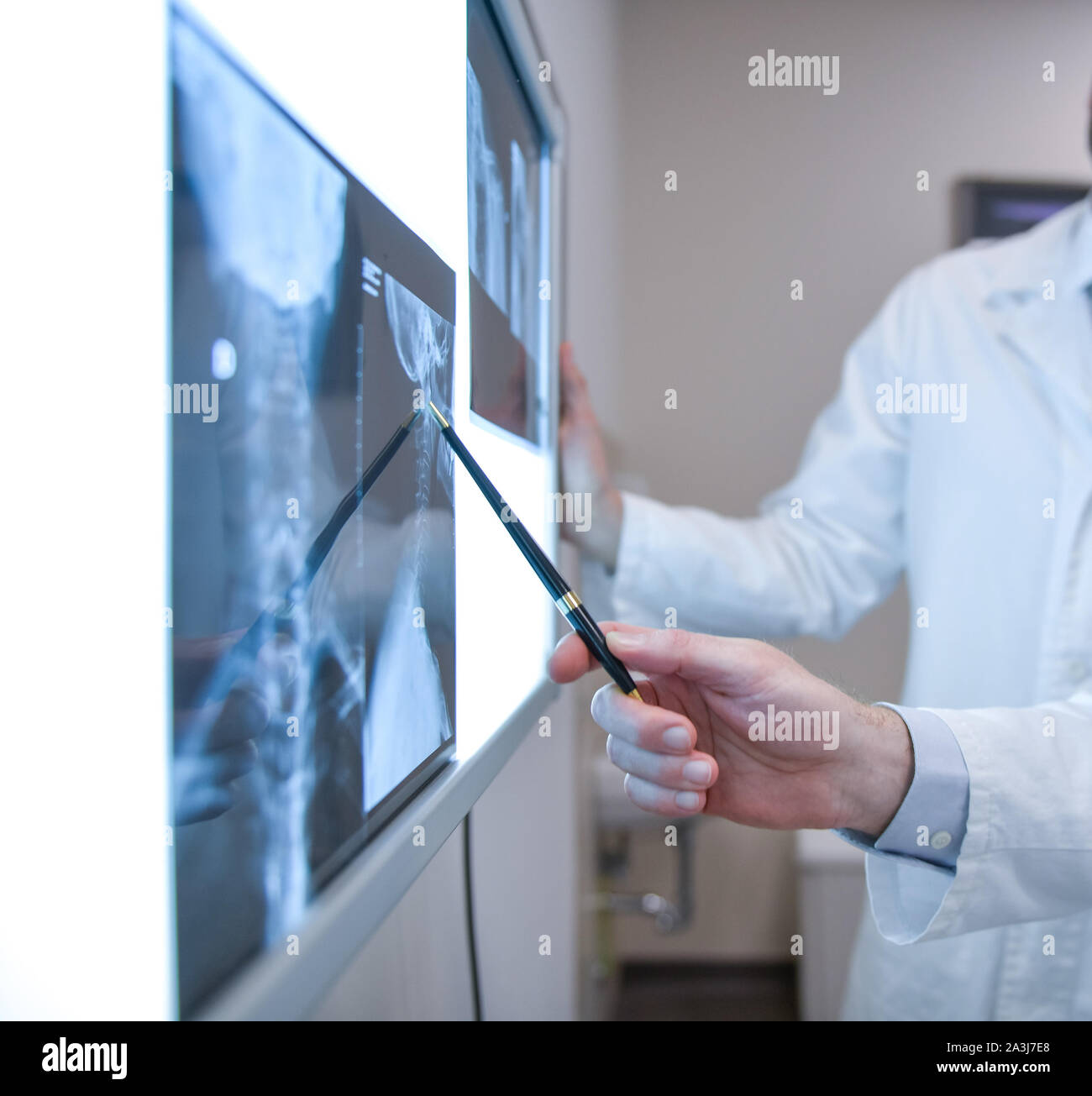 Ärzte Prüfung X-Ray Prüfungen Stockfoto