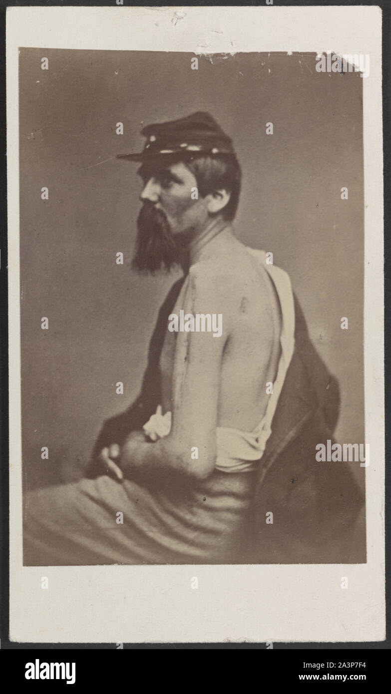 Soldat namens Ewing in kepi Anzeigen eine Wunde an seinem Arm] / Henry Ulke, 178 Pennsylvania Avenue, Washington, D.C Stockfoto