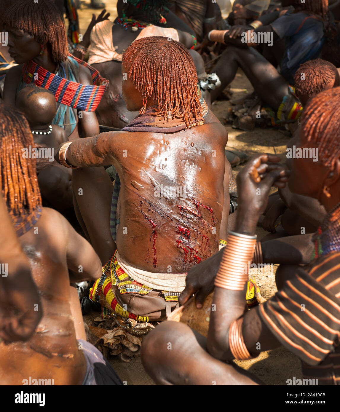 Äthiopien: Blut aus den Wunden von einem kürzlich geschlagene Frau. Schockierende Bilder zeigen die seltsamen Sitten der Stämme in der Omo Valley, wo Frauen Stockfoto