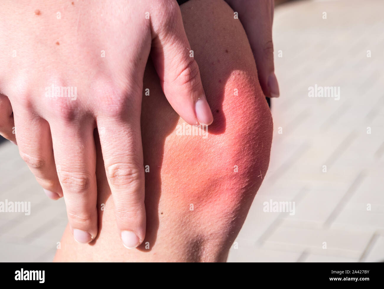 Schmerzen in seinem Knie Stockfoto