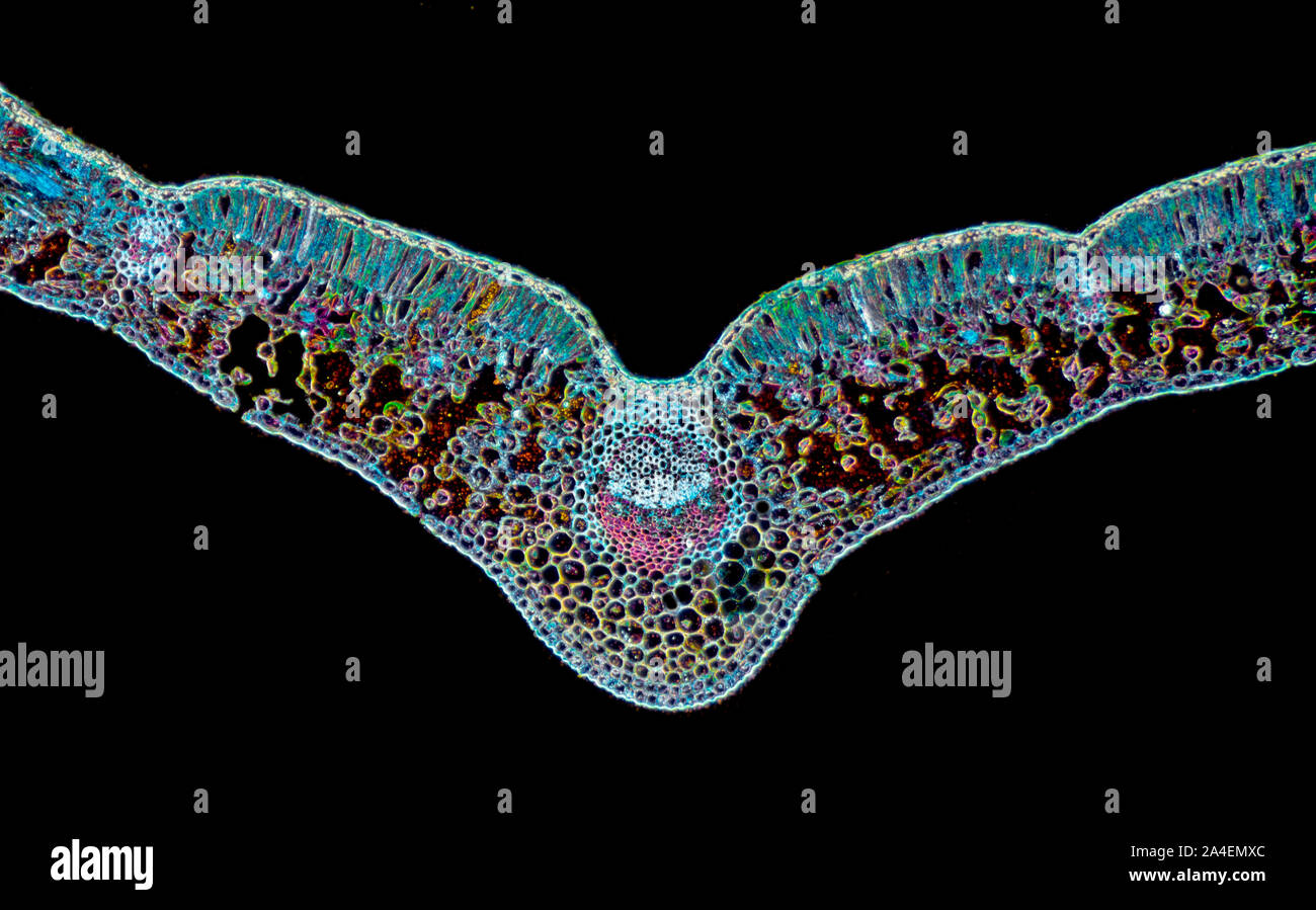 Helleborus niger Christrose, gebeizt Blatt Abschnitt, TS. Darkfield photomicrograph Stockfoto