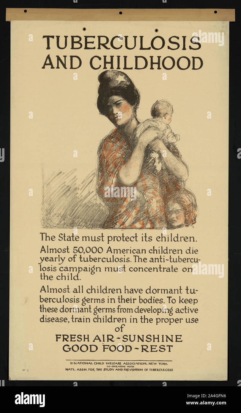 Tuberkulose und Kindheit Stockfoto