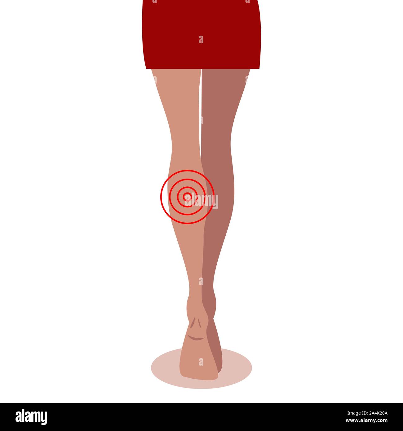 Shin Schmerzen, Krankheiten der weiblichen Beinen, Pflege für Körper, womans Gesundheit, Krampfadern. Vector Illustration Stock Vektor