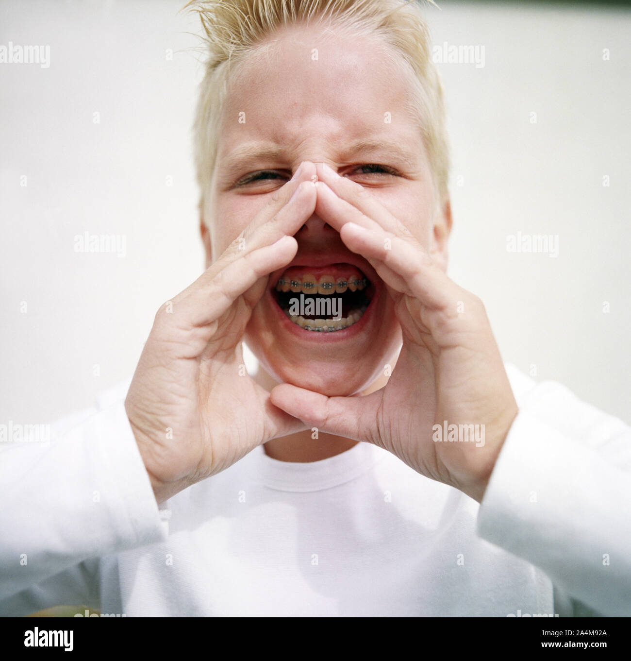 Junge mit Zahnspange - schreien Stockfoto