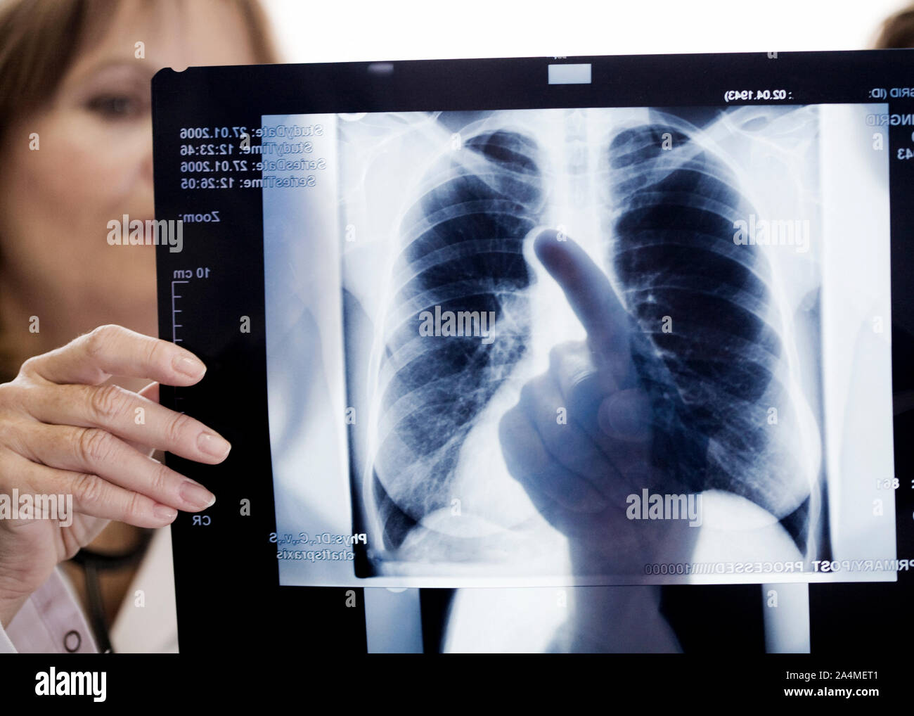 Arzt Untersuchung Röntgen Stockfoto
