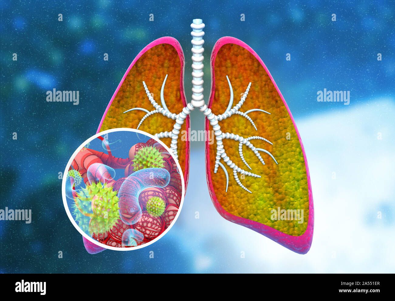 Viren, Bakterien in die menschliche Lunge. 3D-Darstellung Stockfoto