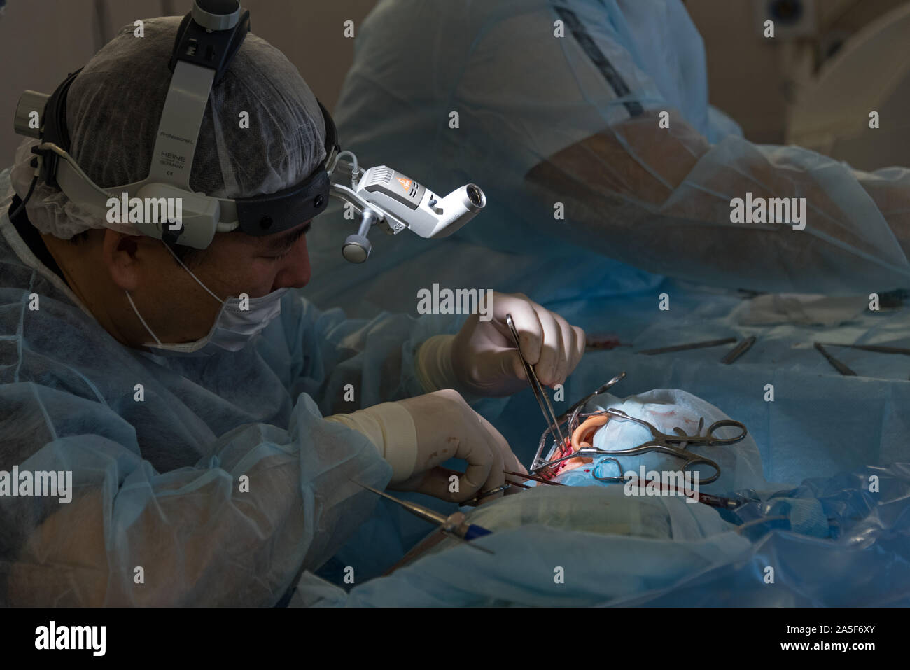 Die Cochlear Implantation Chirurgie Operation in der Medizinischen Klinik in Astrachan, Russland Stockfoto