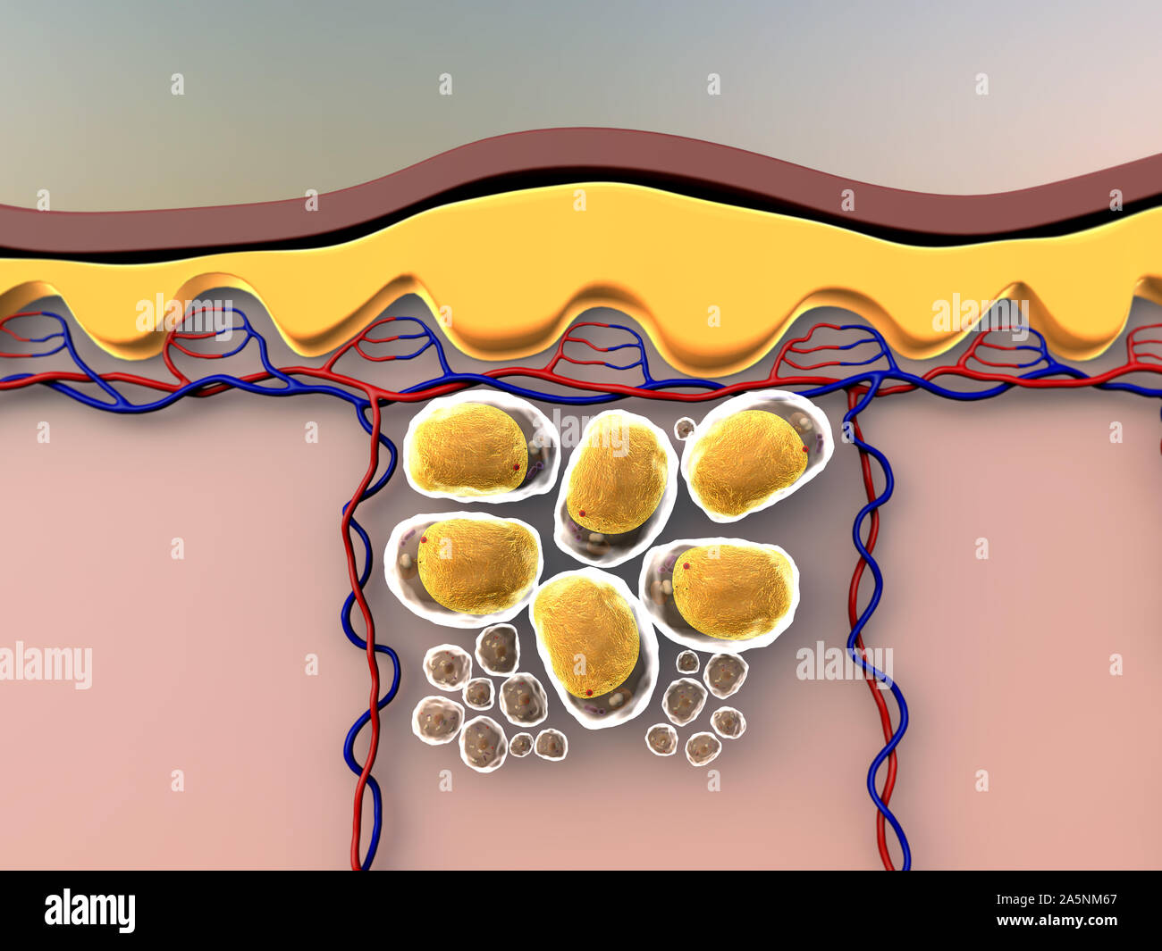 Subkutane Fett, Abbildung der menschlichen Leder Anatomie, Fettzellen und Vene, Fettzellen unter der Haut Stockfoto