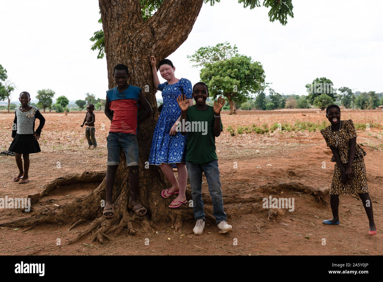 In Malawi, Menschen mit Albinismus werden getötet und ihre Körper geerntet; Kinder und Erwachsene zum Tod mit Macheten und Küche Messer gehackt. Mehr als 163 Menschen haben in den vergangenen zwei Jahren angegriffen wurde, mindestens 22, tödlich. Diejenigen, die überlebt haben, wurden mit tiefe körperliche und seelische Narben hinterlassen, und ängstlich bleiben, dass diejenigen, die Jagd auf sie zurück. Das junge Mädchen mit Albinismus, nur ein Kind von einem Elternteil im Haushalt, sagt Abschluss Schule ist Ihre einzige Hoffnung für die Zukunft. Stockfoto