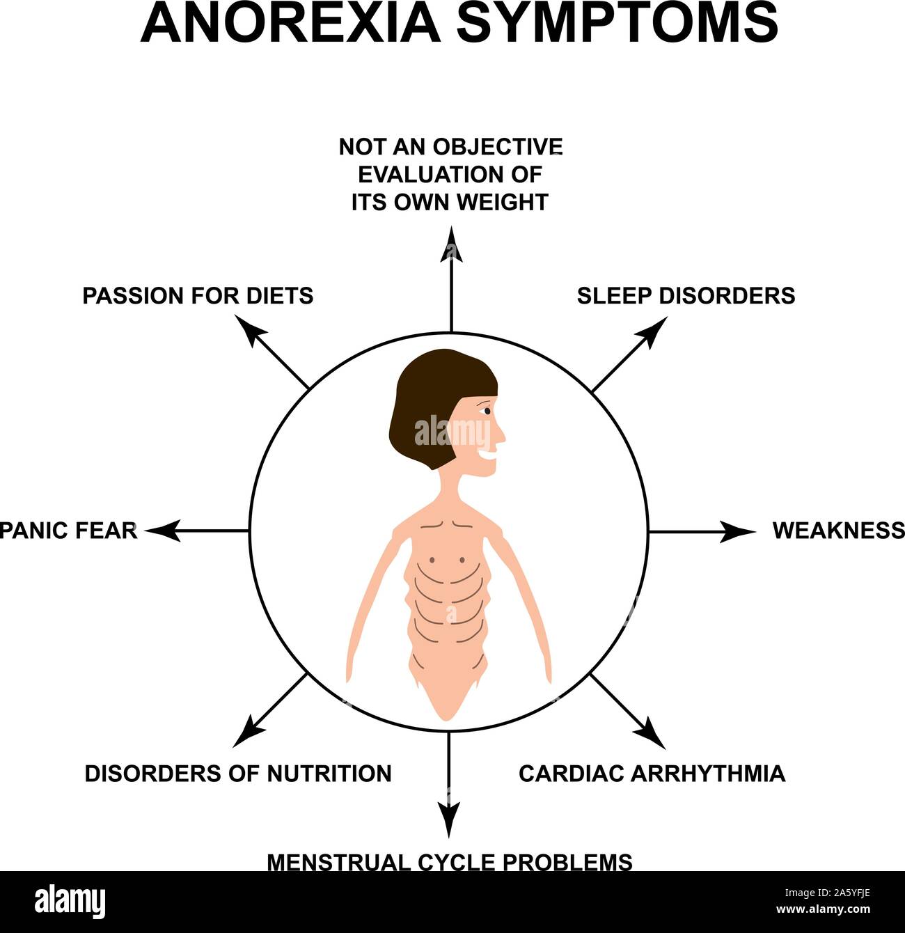 Magersucht Symptome. Schlanken Körperbau mit Magersucht. Infografiken. Vector Illustration auf isolierte Hintergrund. Stock Vektor