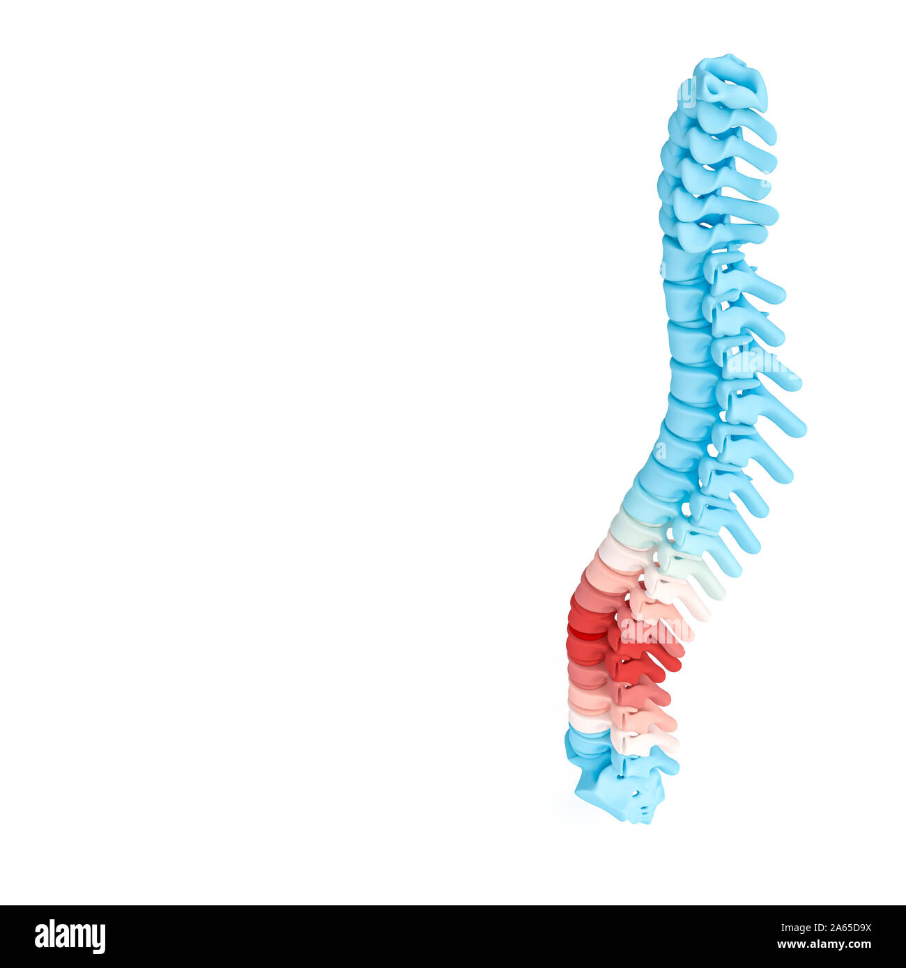 3d-Grafik Rendern einer Wirbelsäule mit Schmerzenden markierten Teile. Zurück Care Concept. Stockfoto