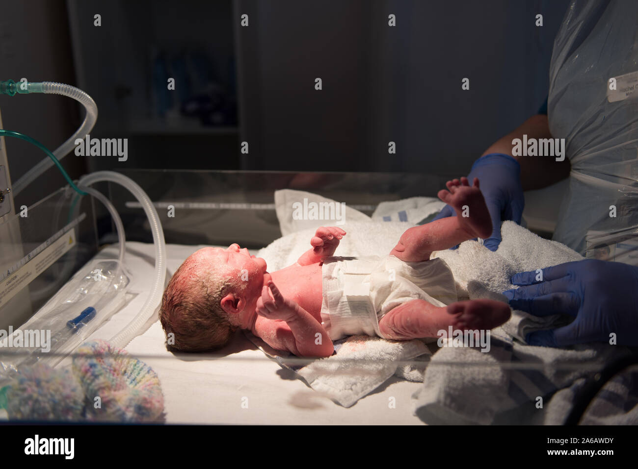 Ein junges Mädchen ist verfrüht, mit einem Gewicht von nur 4 kg, hier dargestellt in weniger als 5 Minuten alt, Mutterschaft, NHS, North Staffordshire Krankenhaus geboren Stockfoto