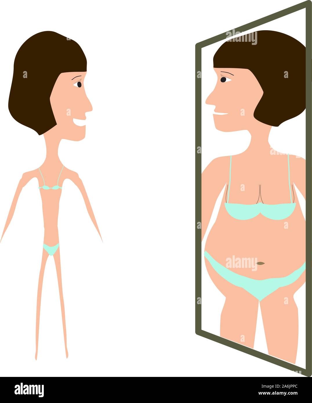 Magersucht. Schlanken Körperbau mit Magersucht. Reflexion der Fettleibigkeit in den Spiegel. Infografiken. Vector Illustration auf isolierte Hintergrund. Stock Vektor