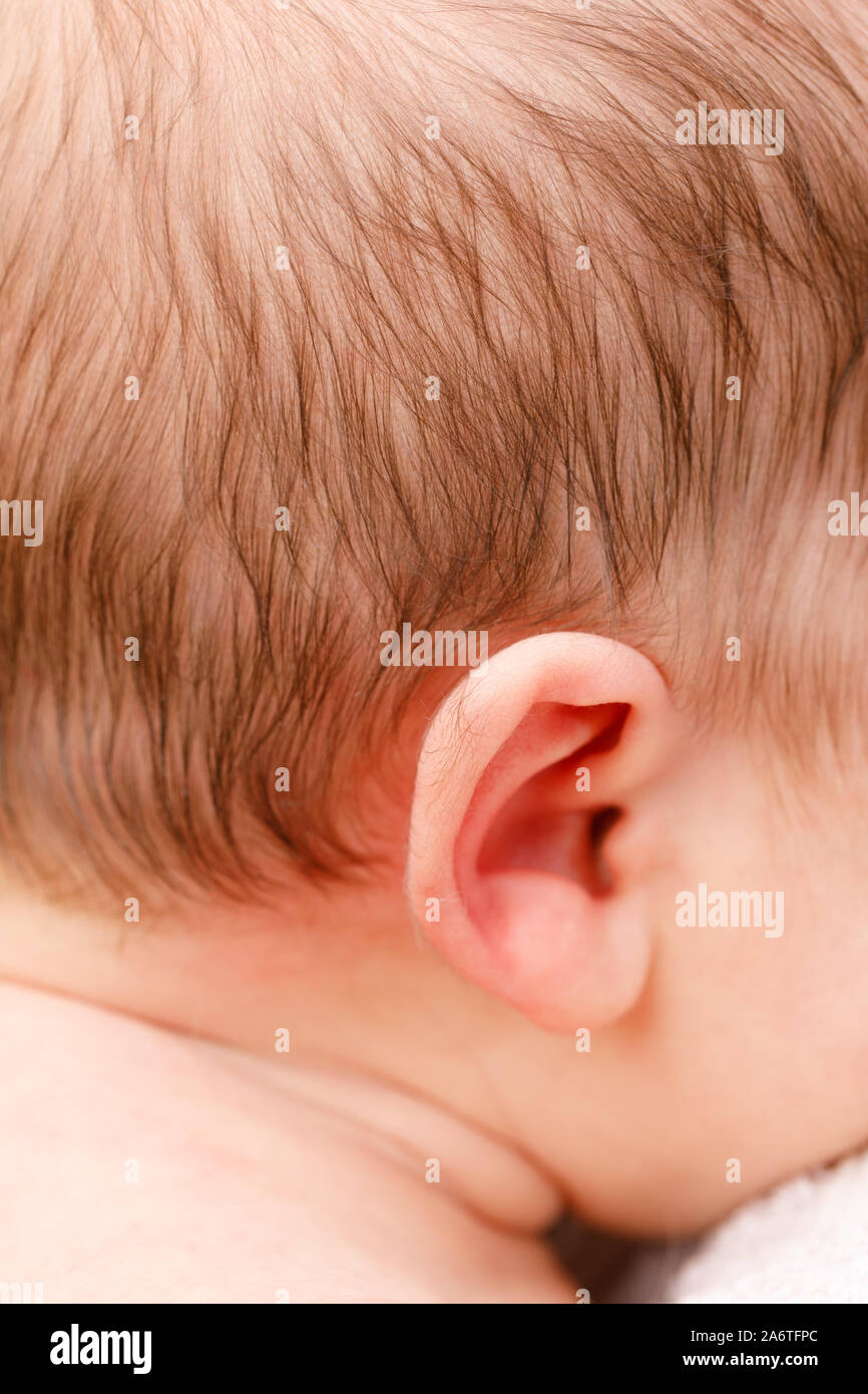 Neugeborenes Baby Ohr mit dünnen flaumige Haar als Lanugo Symptom bekannt  Stockfotografie - Alamy