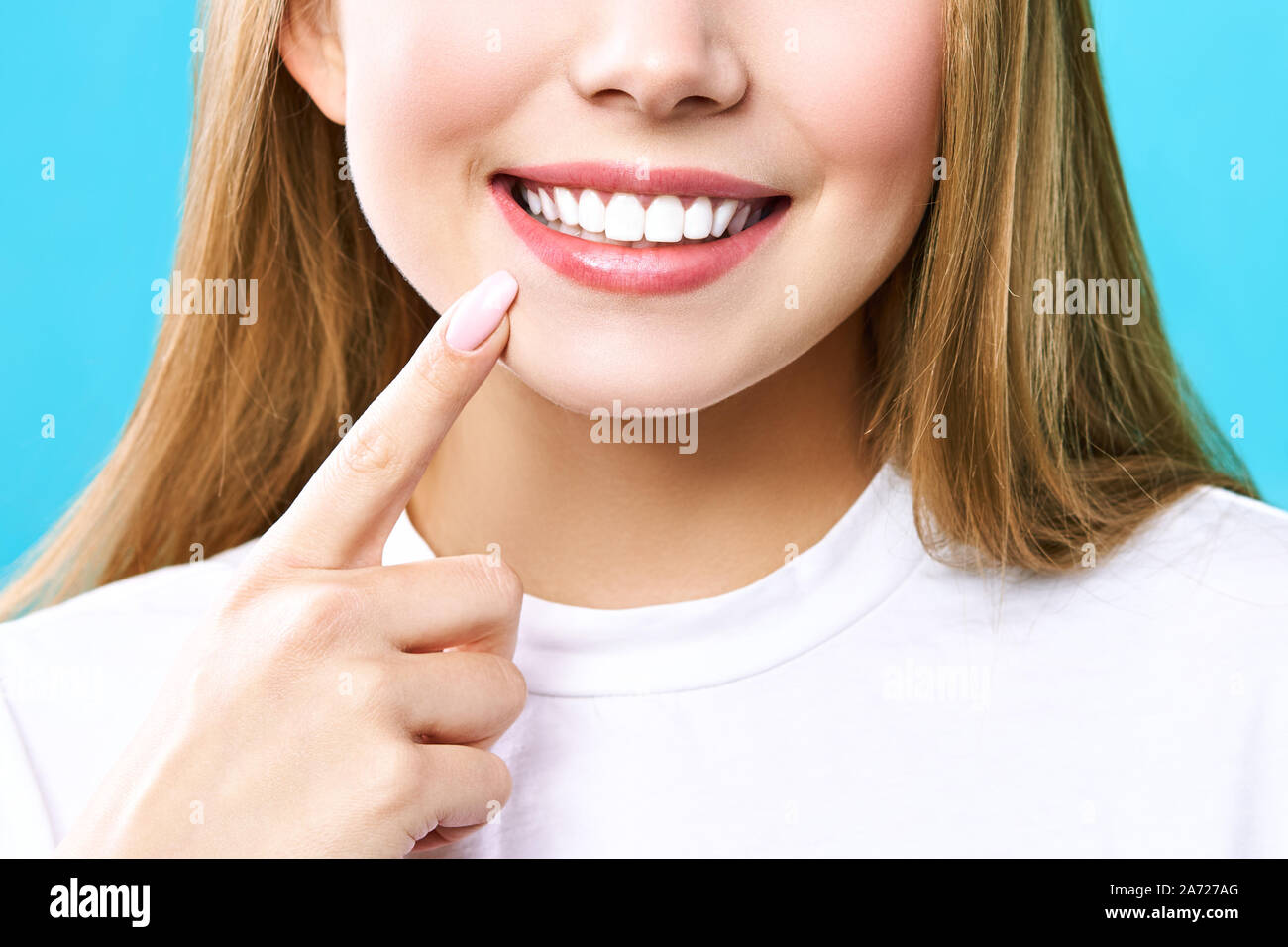 Perfekt gesunde Zähne Lächeln einer jungen Frau. Zähne, die. Zahnmedizinische Klinik Patienten. Bild symbolisiert Oral Care Zahnheilkunde, Zahnmedizin. Stockfoto