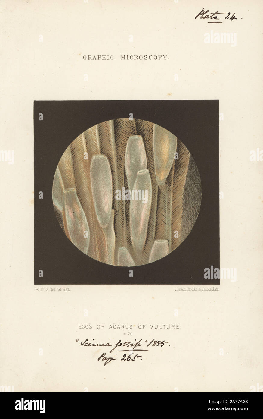 Eier der acarus Milbe auf Geier Federn, vergrößerte x 70. Chromolithograph nach einer Illustration von E.T.D., Lithographiert von Vincent Brooks, von 'Grafik Mikroskopie" Platten zu veranschaulichen" hardwicke's Science Klatsch", London, 1865-1885. Stockfoto