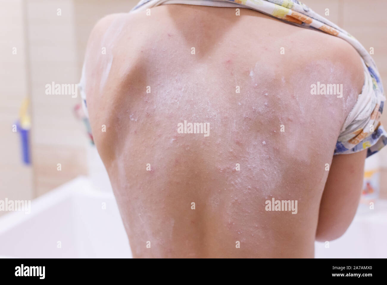 studie anabole steroide Mit diesen 5 Tipps wie ein Profi