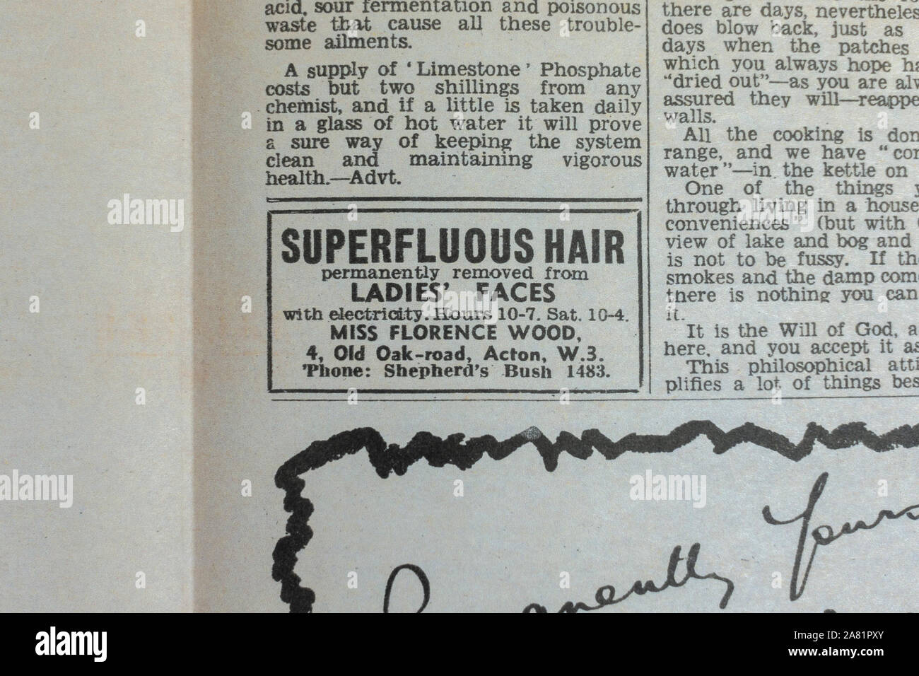 Kleine Anzeige für uperfluous' Gesichtshaarabbau: Täglich Skizze Zeitung (Nachbau), 19. Juni 1940 (während der Schlacht von Großbritannien). Stockfoto