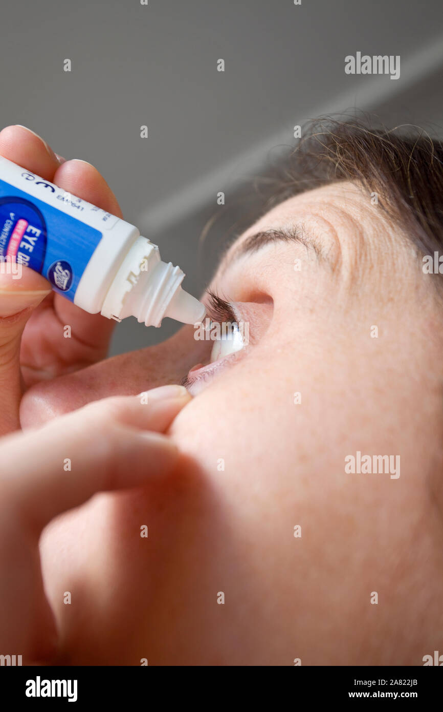 Frauen mit Auge Lösung für trockene Augen Stockfoto