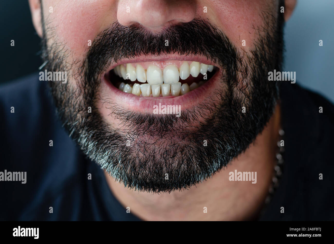 Close up Portrait eines bärtigen Mannes seine Zähne abgeschnitten. Stockfoto