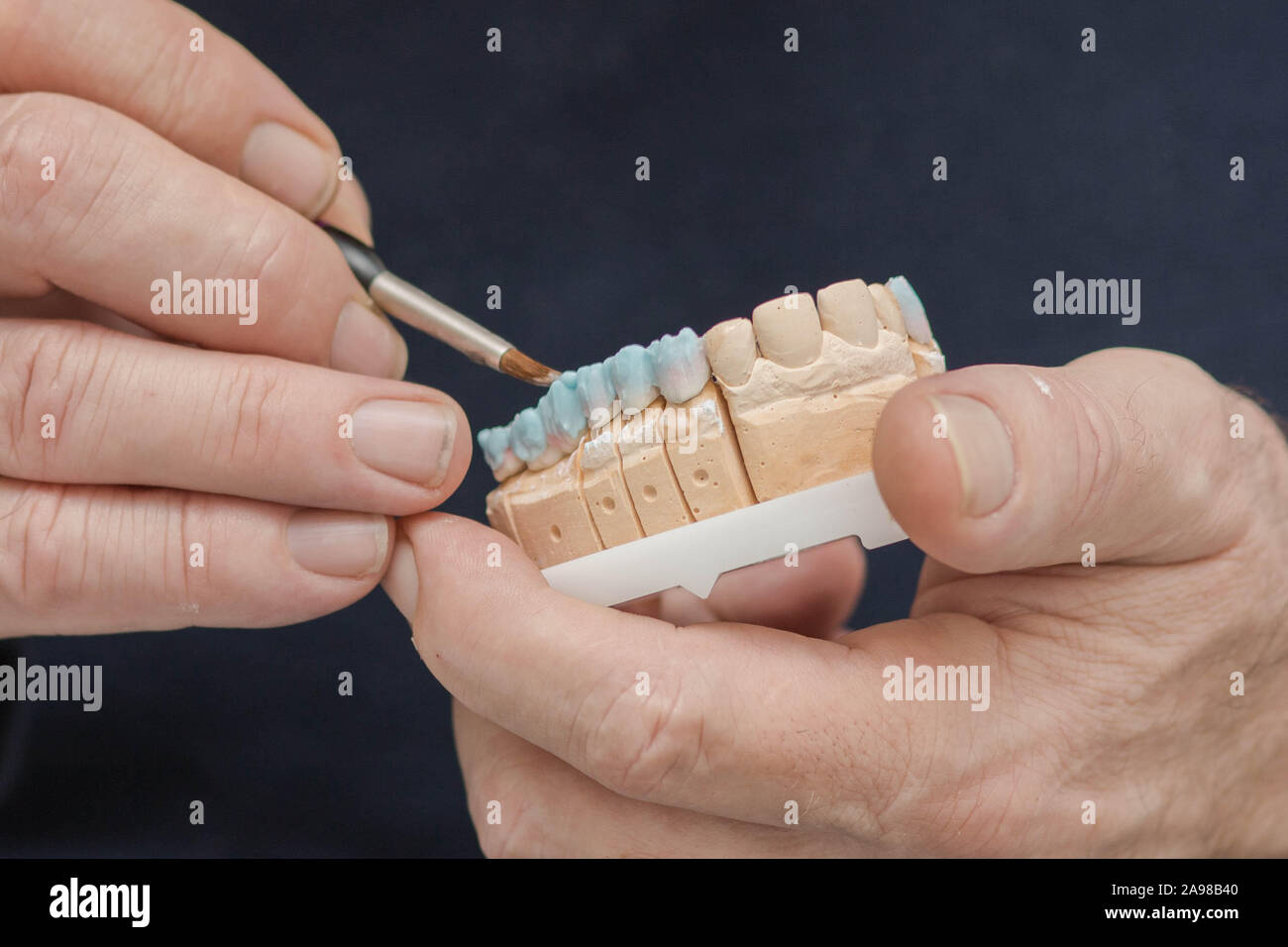 Zahnmedizinische putz Stein Modell mit zirkonium Brücke und der Anwendung von Keramik in Arbeit durch den Zahntechniker Stockfoto