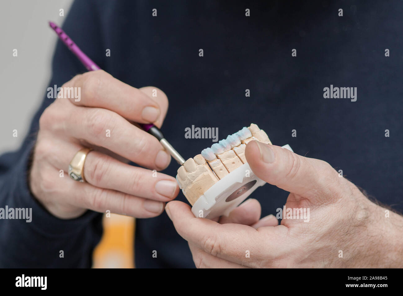 Zahnmedizinische putz Stein Modell mit zirkonium Brücke und der Anwendung von Keramik in Arbeit durch Zahntechniker Stockfoto
