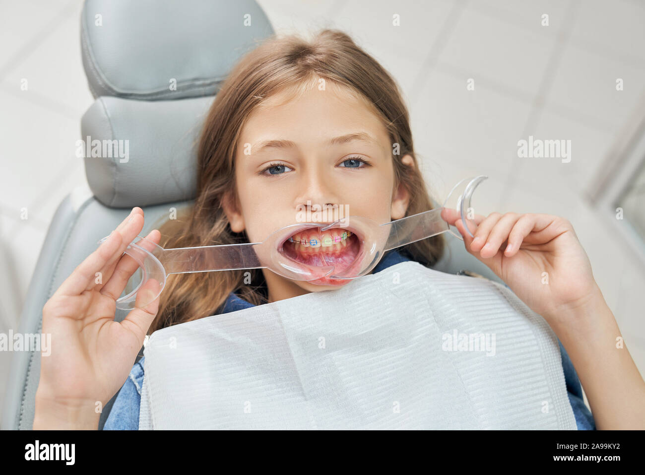 Der mutige junge Mädchen, dass Mund Gurtaufroller. Schöne Patient im Behandlungsstuhl sitzen mit Mund und zahnmedizinische weißes Lätzchen, an der Kamera schaut. Stockfoto