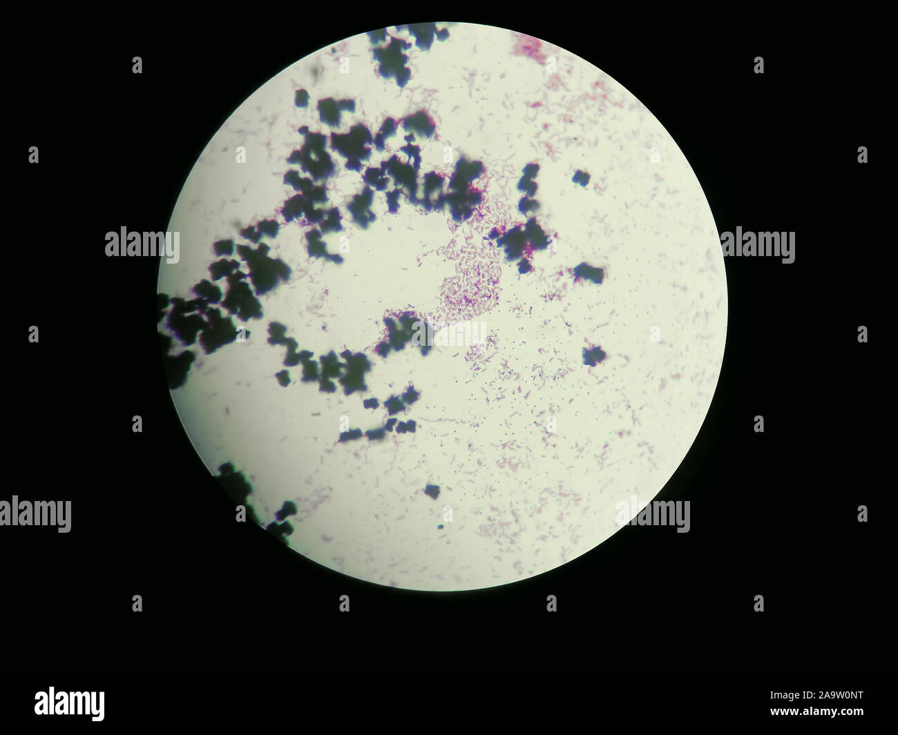 Bild von Escherichia coli, die durch ein Lichtmikroskop. Für alle purprose. Stockfoto