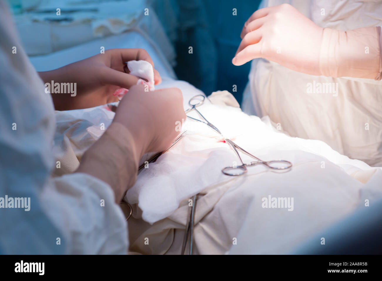 Der Chirurg und sein Assistent arbeiten, die in einem sterilen Op. Nahaufnahme der Hand einer pädiatrischen Chirurg. Phase der Operation für eine Urologische dise Stockfoto