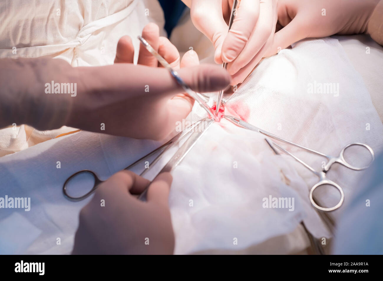 Der Chirurg und sein Assistent arbeiten, die in einem sterilen Op. Nahaufnahme der Hand einer pädiatrischen Chirurg. Phase der Operation für eine Urologische dise Stockfoto