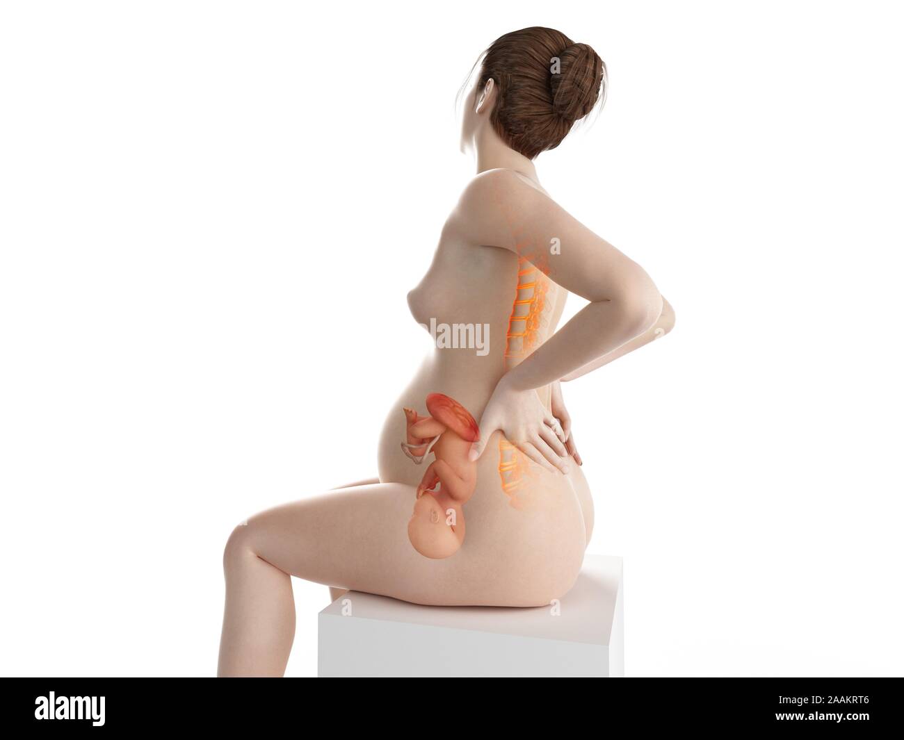 Schwangere Frau mit Rückenschmerzen, computer Abbildung. Stockfoto