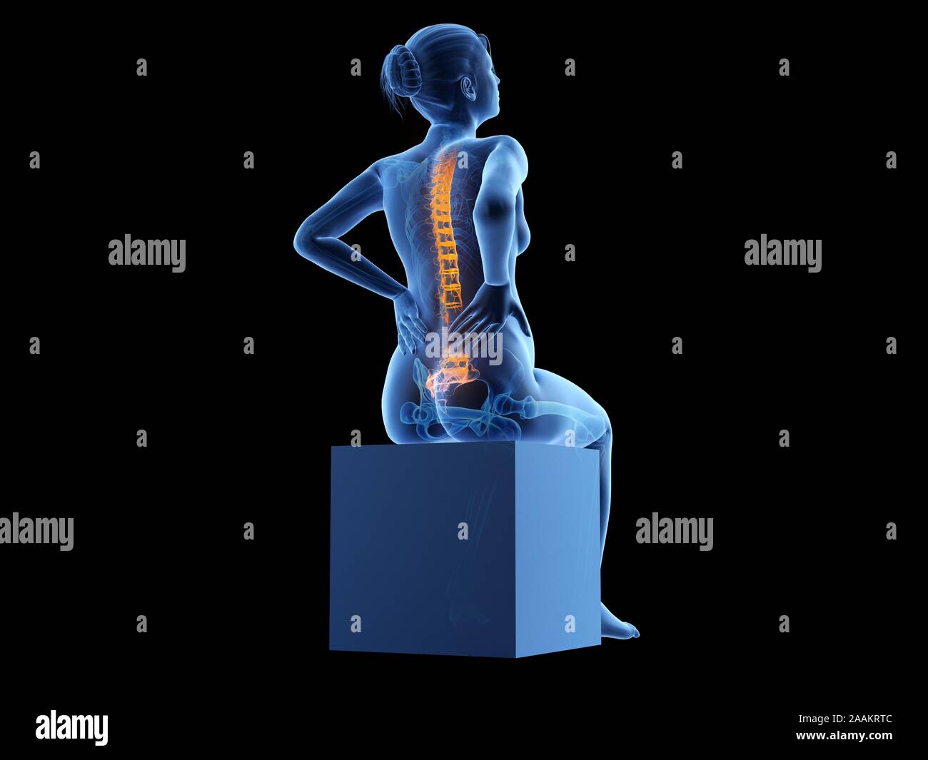 Schwangere Frau mit Rückenschmerzen, computer Abbildung. Stockfoto