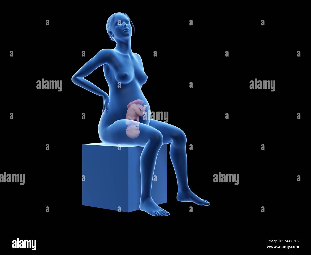 Schwangere Frau mit Rückenschmerzen, computer Abbildung. Stockfoto