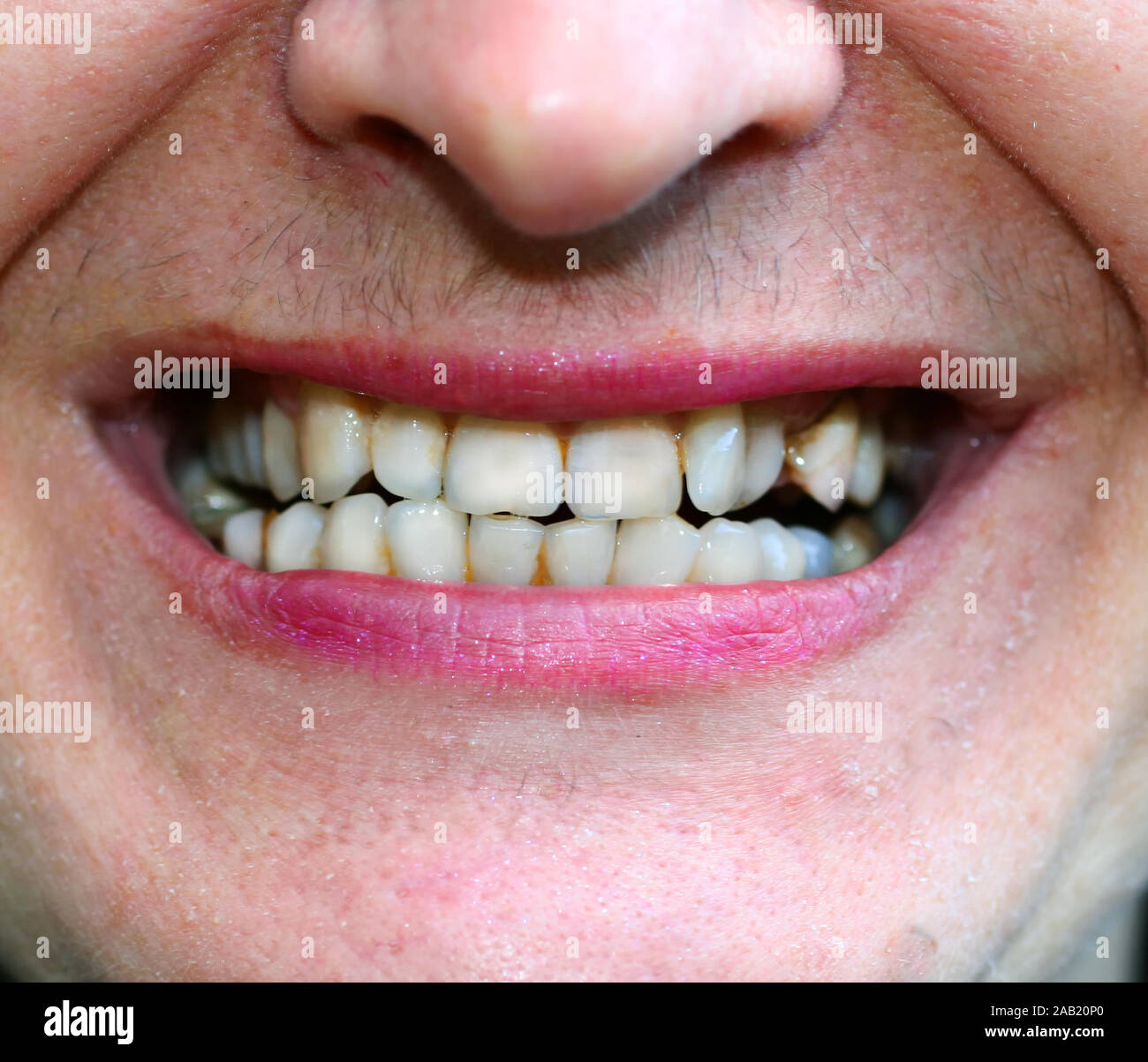 Orthodontia Fotos Und Bildmaterial In Hoher Aufl sung Alamy