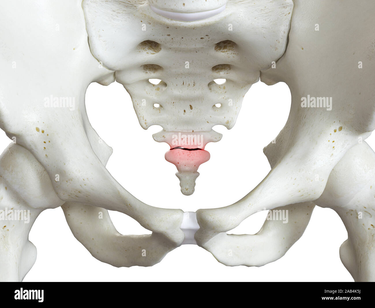 3D-gerenderte Medizinisch genaue Abbildung: ein gebrochenes Steißbein Stockfoto