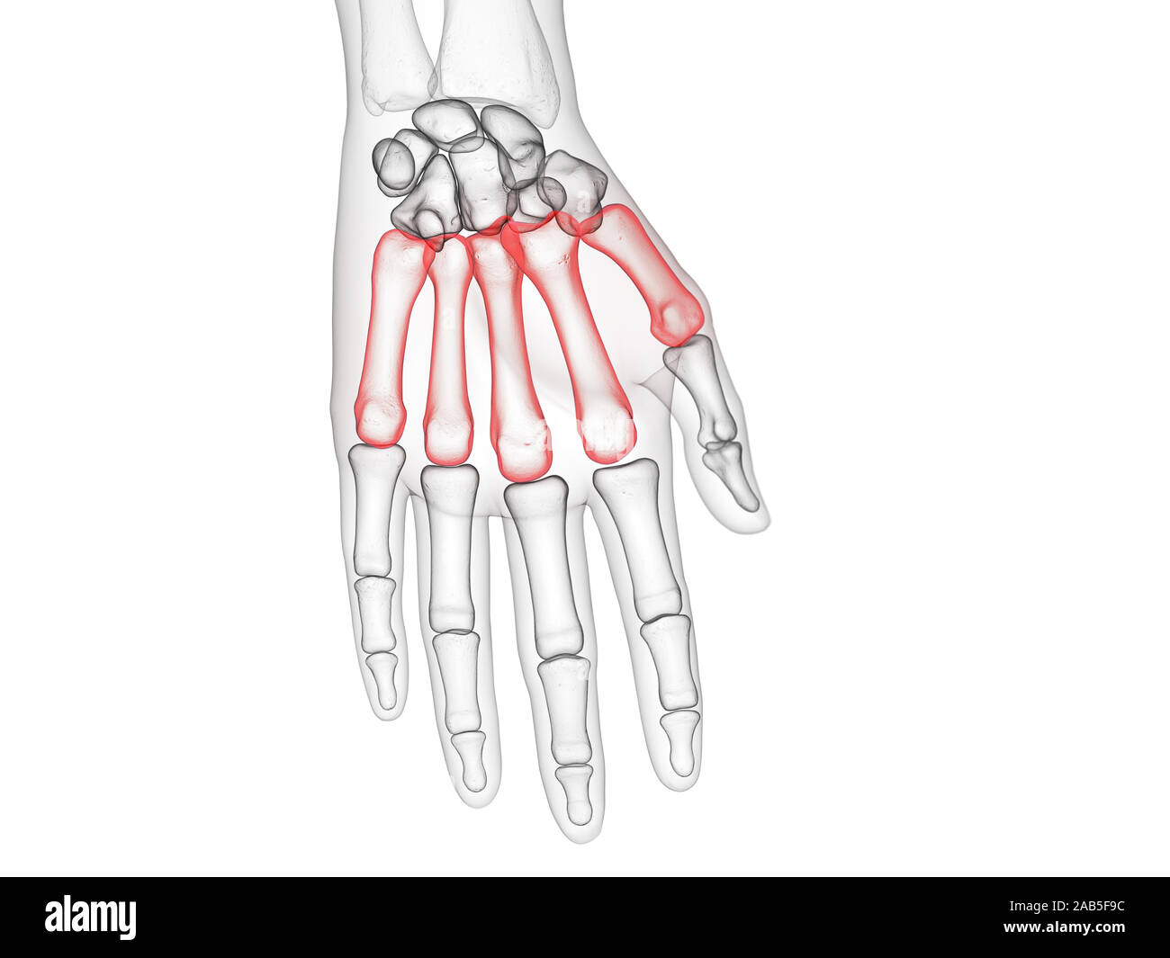 3D-gerenderte medizinisch genauen Abbildung des metacarpal Bone Stockfoto