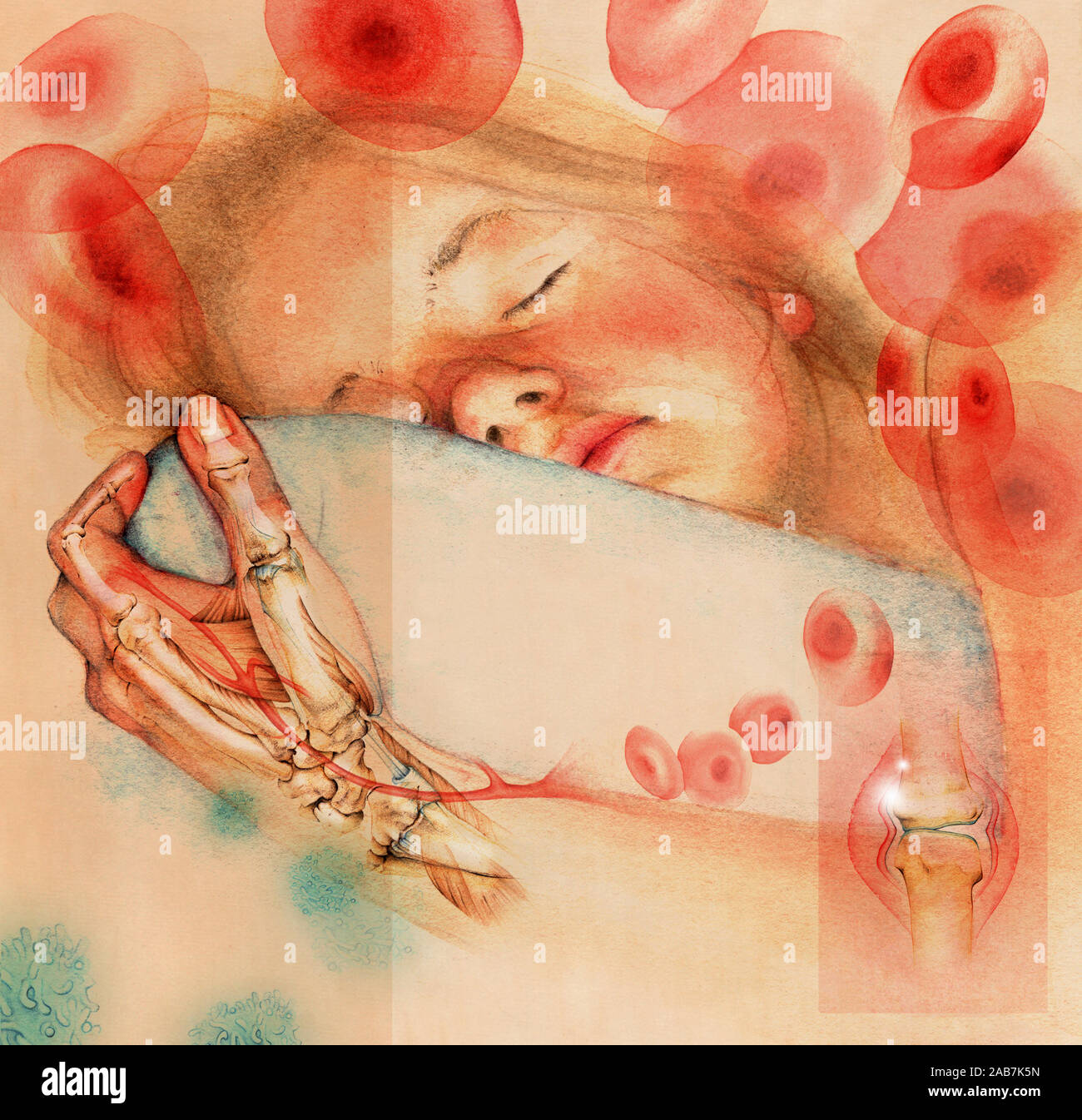 Schlafendes Mädchen mit entzündlichen Arthritis in transparenten hand Stockfoto