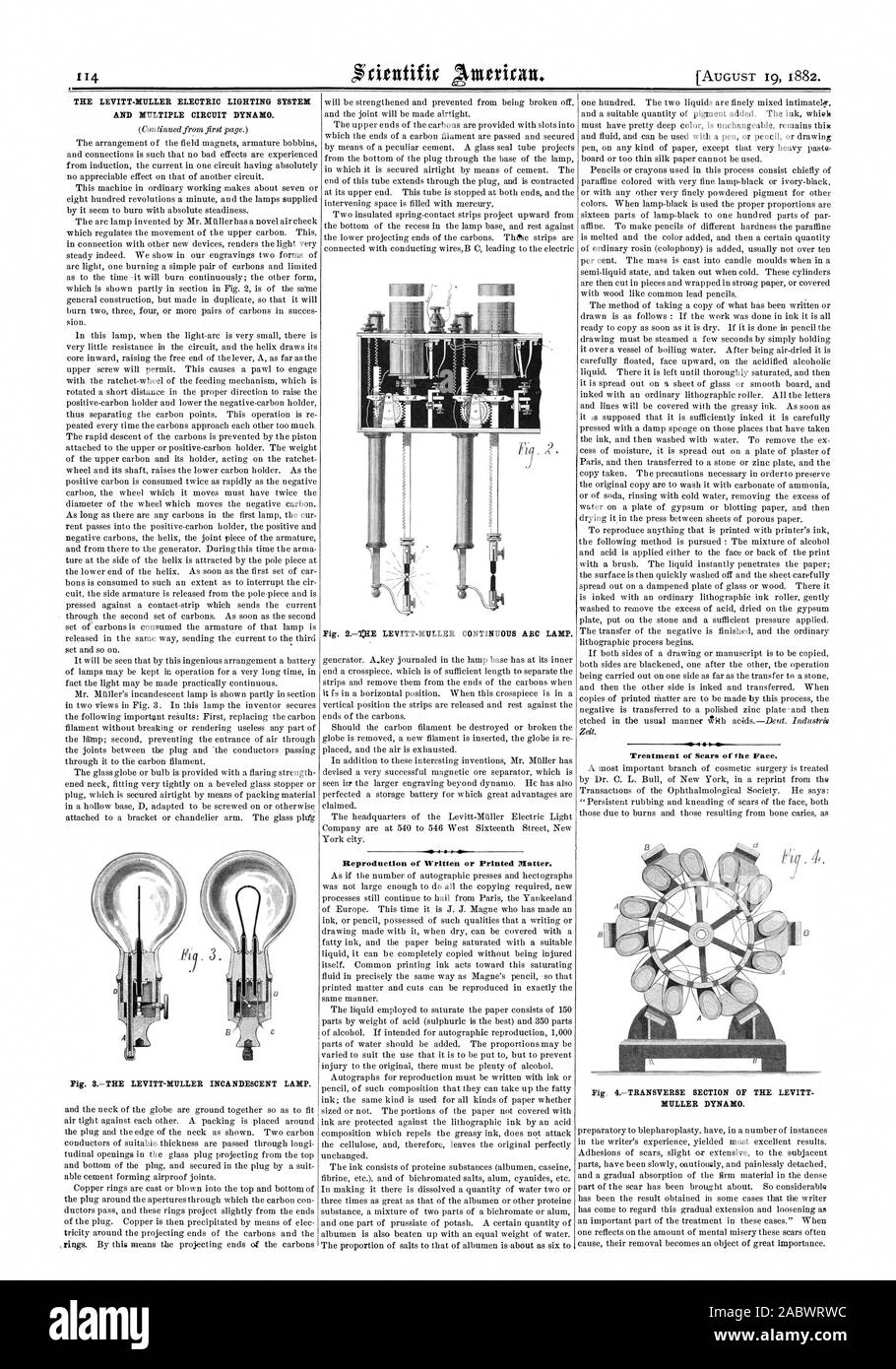 Rientific Anterian. Die LEVITT - MULLER ELEKTRISCHE BELEUCHTUNGSSYSTEM UND MEHRERE STROMKREIS DYNAMO. -44 P 4 4 Es II Behandlung von Narben im Gesicht. MULLER DYNAMO., Scientific American, 1882-08-19 Stockfoto