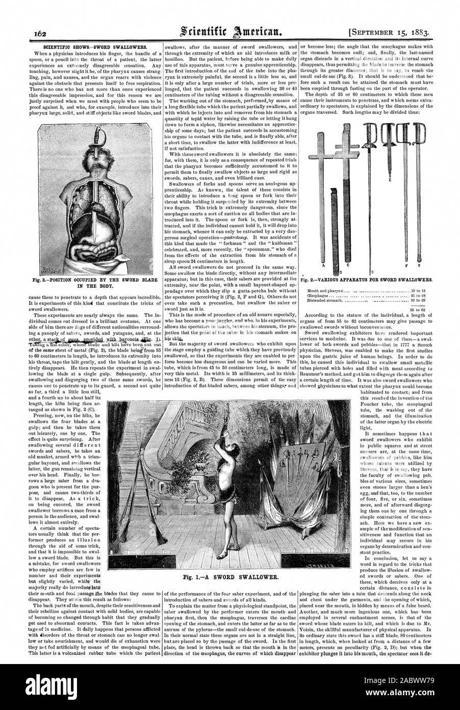 Wissenschaftliche SHOWSSWORD SWALLOWERS. Abb. 1 Ein Schwert SWALLOWER. Abb. SPOSITION BELEGT DURCH DAS SCHWERT BLADE IM KÖRPER., Scientific American, 83-09-15 Stockfoto