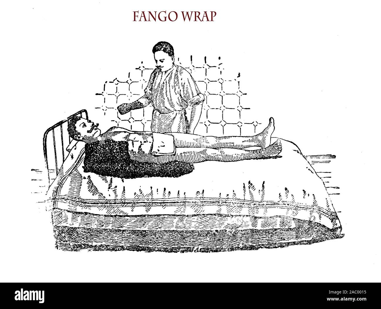 Gesundheitswesen und Medizin: Fango wrap Behandlung für Patienten schulter Krankheit 19. Stockfoto