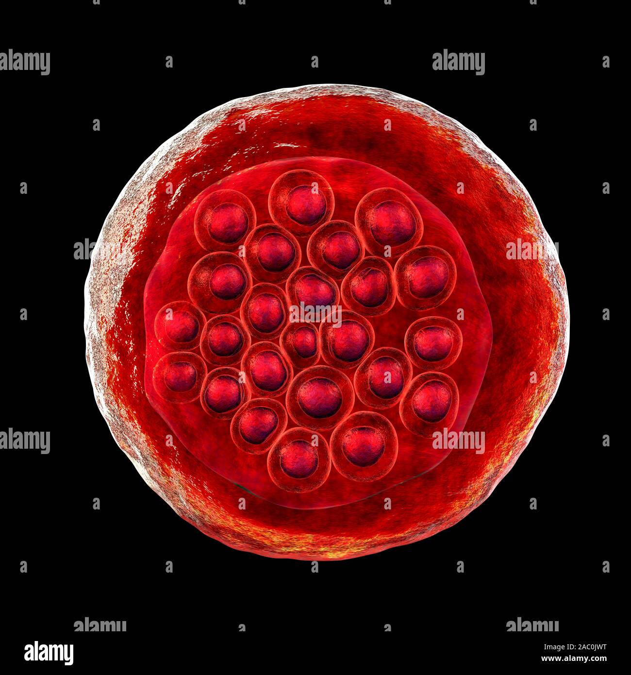 Protozoan Plasmodium falciparum in der Phase der schizont, Il Stockfoto