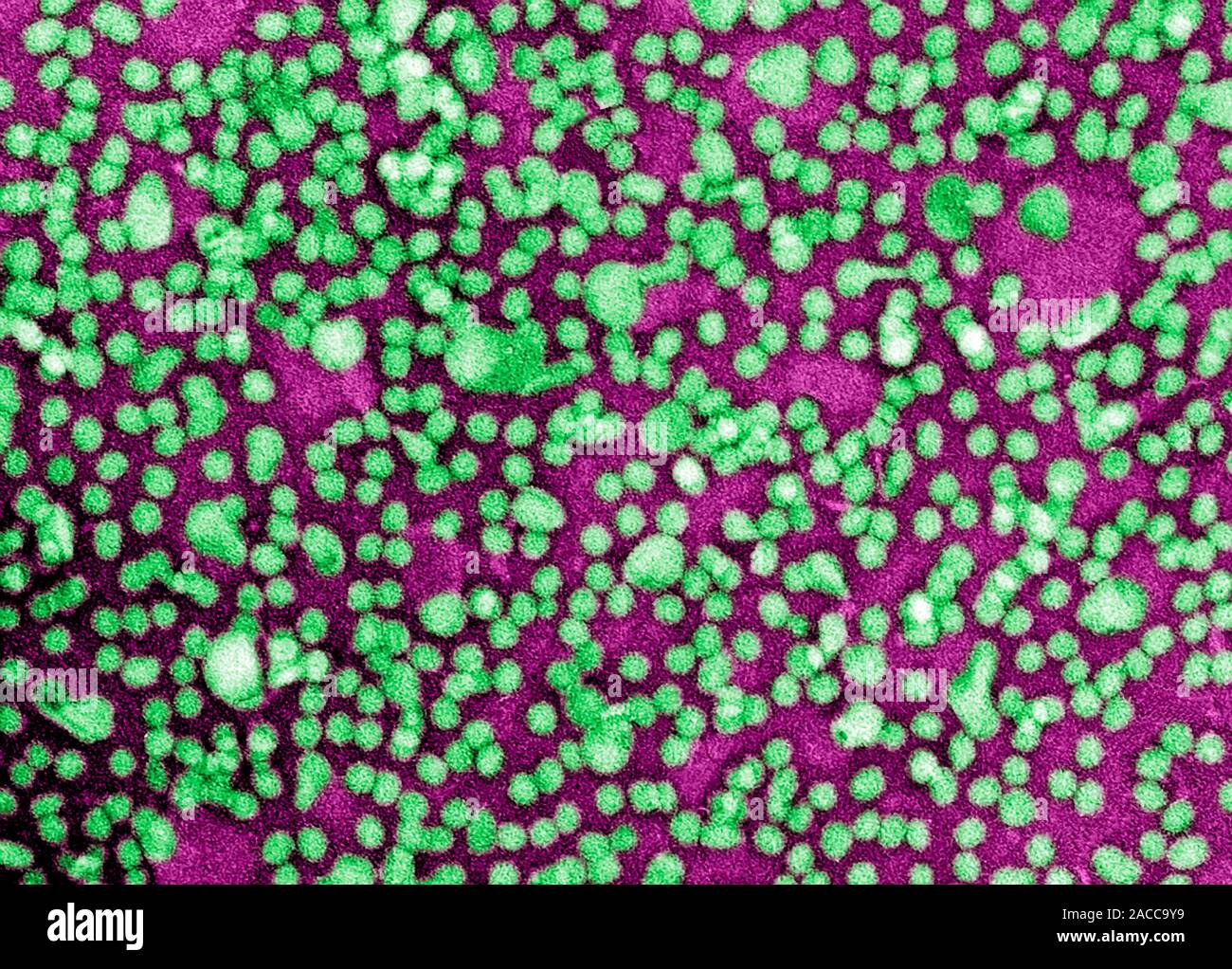 Low-density-Lipoproteine. Farbige Transmission Electron Micrograph (TEM) der low-density-Lipoprotein (LDL) Teilchen. LDLs sind Moleküle, die eine Co Stockfoto