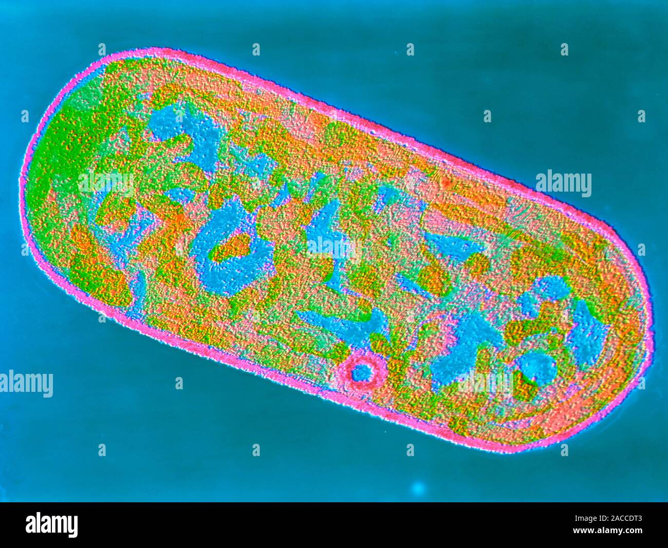 False Farbe Transmission Electron Micrograph (TEM) von Clostridium