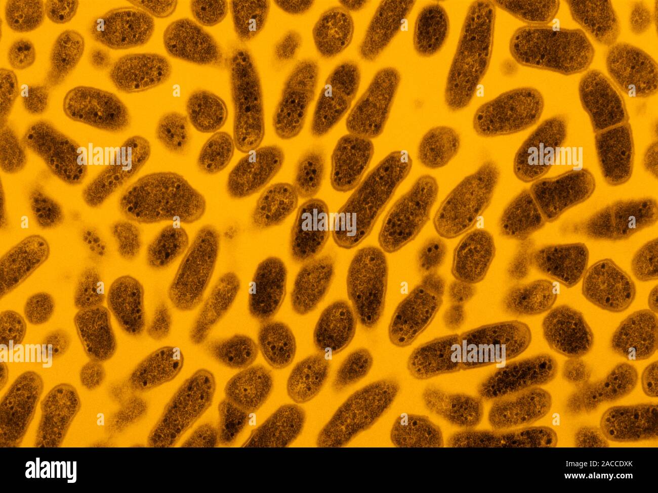 False Farbe Transmission Electron Micrograph einer Kolonie von