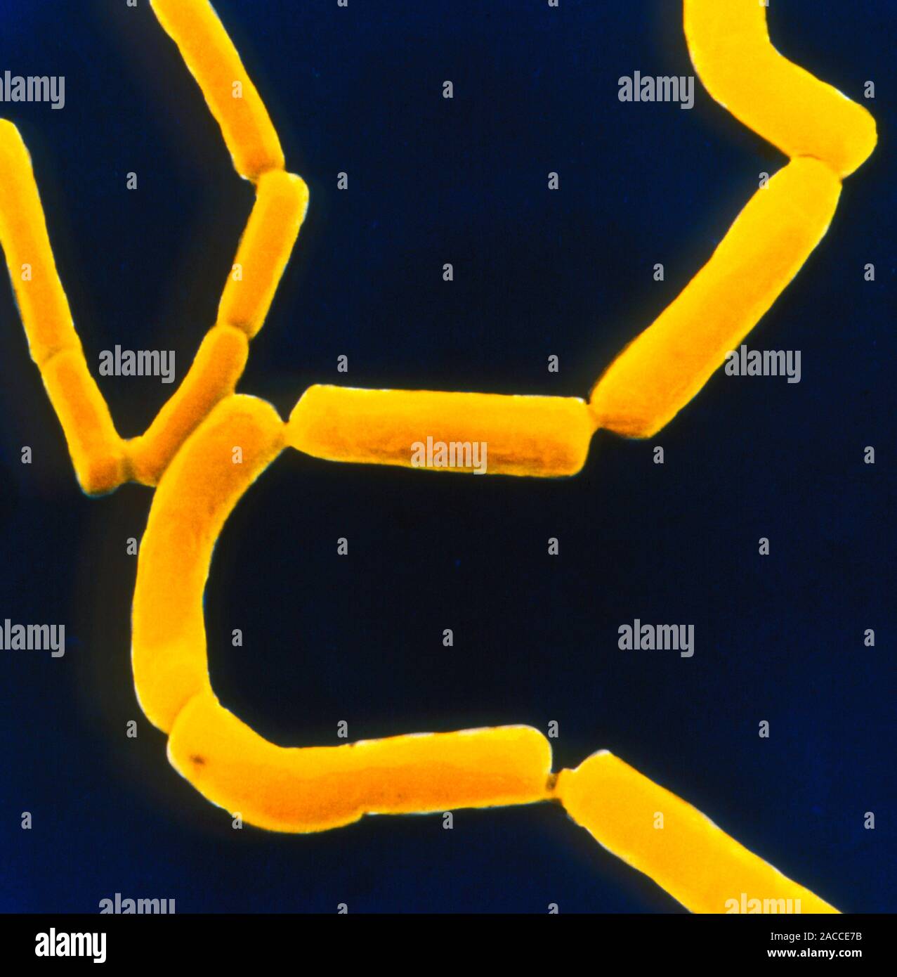 Clostridium perfringens. Farbige Scanning Electron Micrograph von