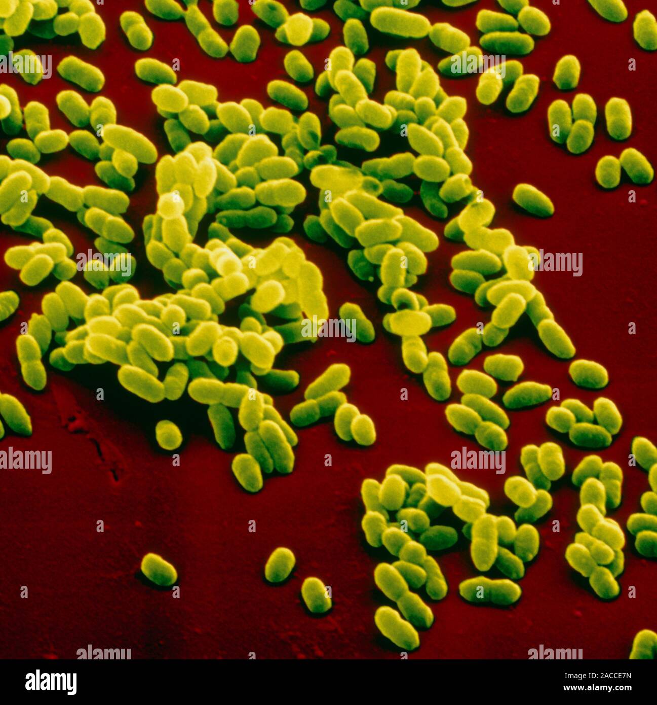 Haemophilus influenzae. Farbige Scanning Electron Micrograph (SEM) aus